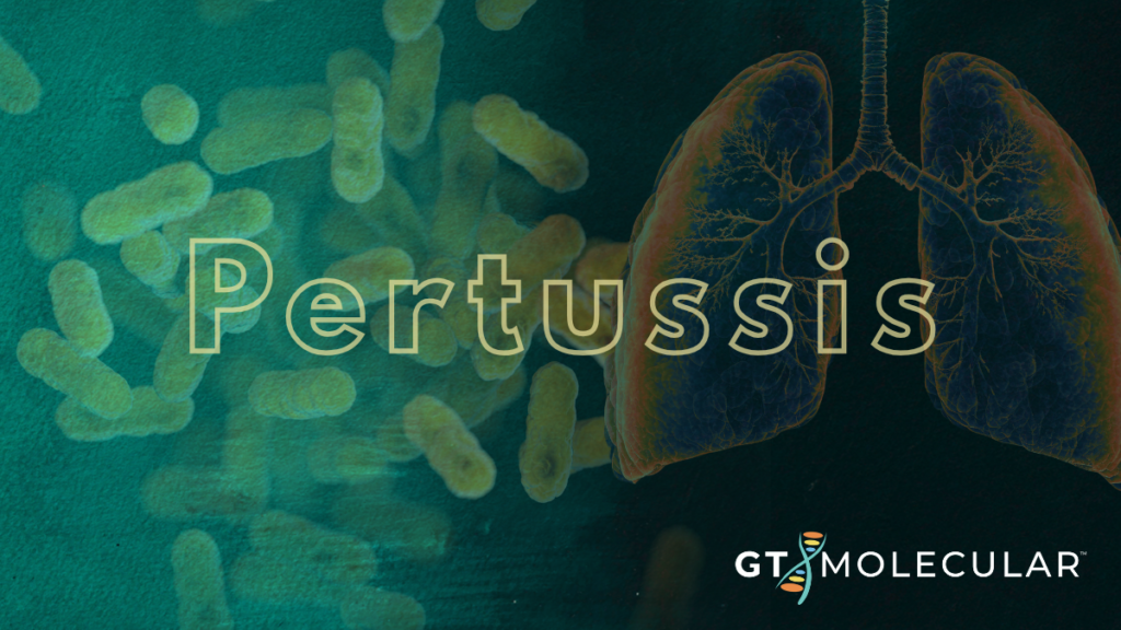 Pertussis in wastewater
