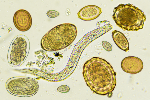 Parasites, bloodborne and enteric pathogen detection