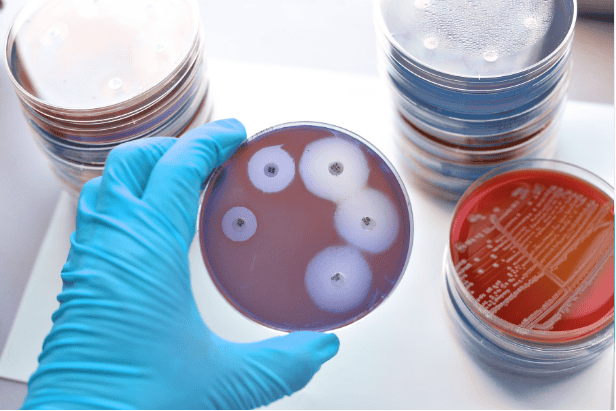 Antimicrobial resistance Microbial culture in petri dish for laboratory testing and research.
